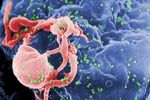 Understanding HIV Prevention: Prevention Methods, Testing & Health Insights