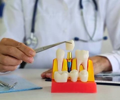CT Scanners Explained: Explore Guide, Basics, Tips, Insights, Knowledge, Facts, and Helpful Resources
