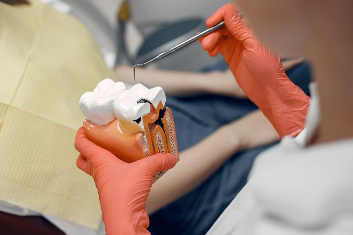 A Guide Root Canal Treatment: Insights, Advice, Basics, and Dental Knowledge