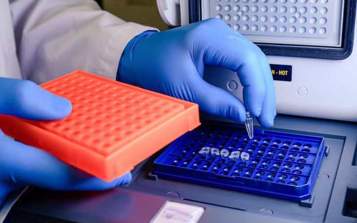 TNF Alpha ELISA Kit Details: Essential Information for Inflammatory Disease and Immune Response Studies