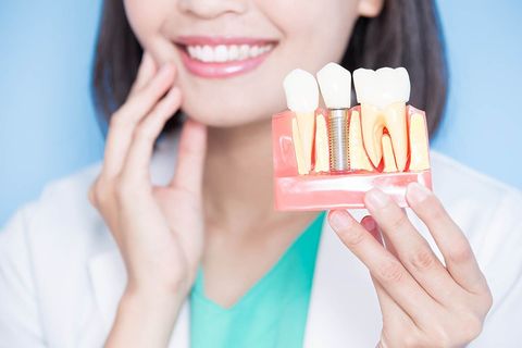 Dental Implant Options Explained: Complete Guide, Costs, Benefits & Expert Tips